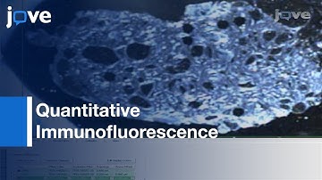 Heterogeneity Mapping: Protein Expression in Tumors