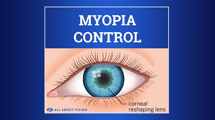 Myopia Control - DayDayNews