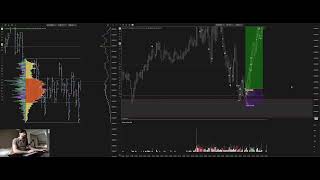 Live Trading With Discord - Trade Recap