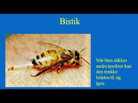 Video: Bi- Eller Hvepsestik - Hævelse, Hævelse Og Allergi Efter Et Bi-stik