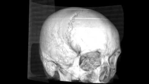 Computed Tomography Brain Imaging 3 - William Edward Hahn #shorts