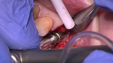 EthOss® Standard Protocol Case