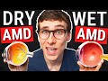 Dry VS Wet Macular Degeneration - Age Related Macular Degeneration (AMD) Explained Mp3 Song