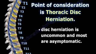 Thoracic Disc Herniation  Everything You Need To Know  Dr. Nabil Ebraheim