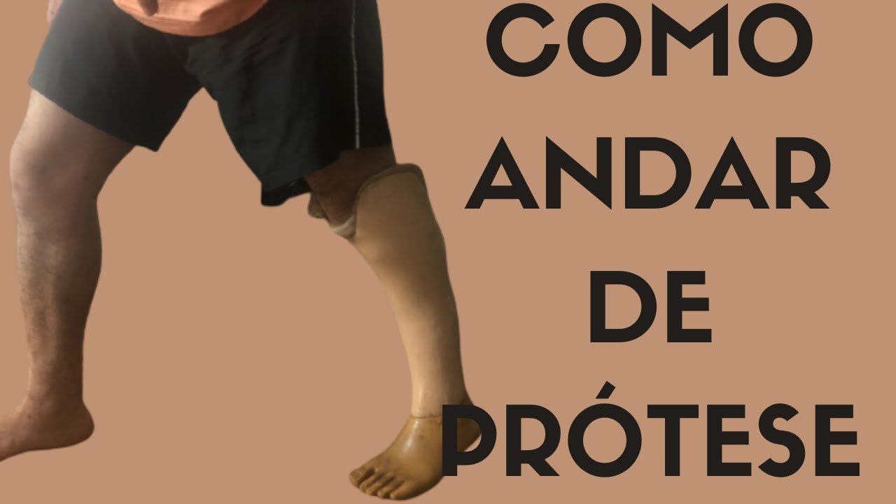 Como Aprender a Andar Com a Prótese #Amputado