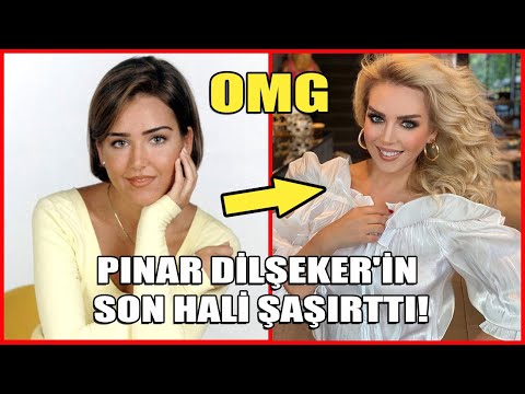 Pınar Dilşeker'in Son Hali Şaşırttı! İşte Pınar Dilşeker'in Büyük Değişimi!