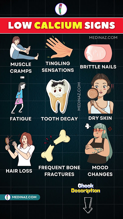 Warning Signs of Low Calcium You Shouldn’t Ignore! #shortsfeed #calciumdeficiency #health #nutrition