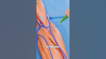 What if needle 💉pierce through your blood vessel #facts #science