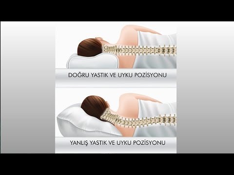 Boyun ağrısının nedenleri nelerdir? - Prof. Dr. Onur Yaman (Nöroşirürji Uz.)