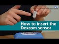 How to insert the Dexcom sensor