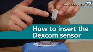 How to insert the Dexcom sensor