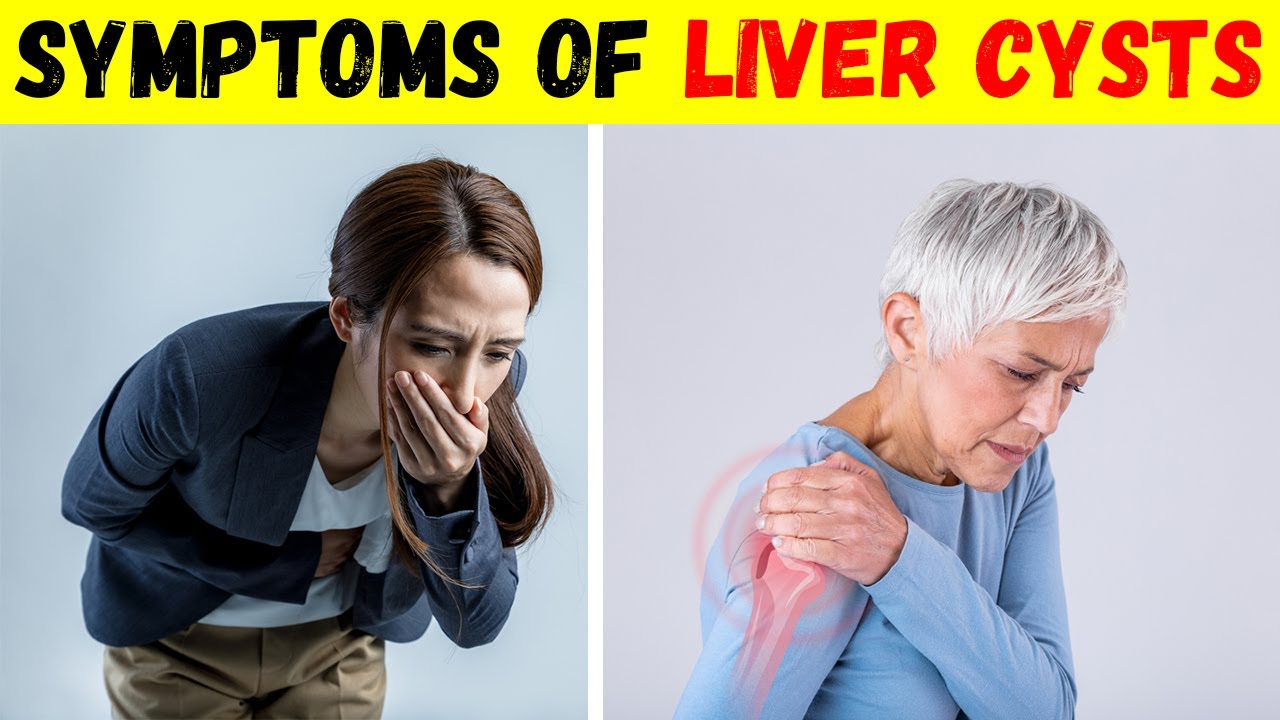 Symptoms Of Liver Cysts And Pain Causes And Treatment Youtube