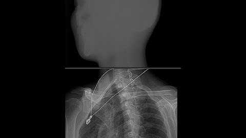 x-ray image enhancement algorithm