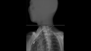 x-ray image enhancement algorithm screenshot 3