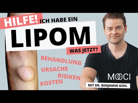 LIPOM - Behandlung, Risiken & Kosten