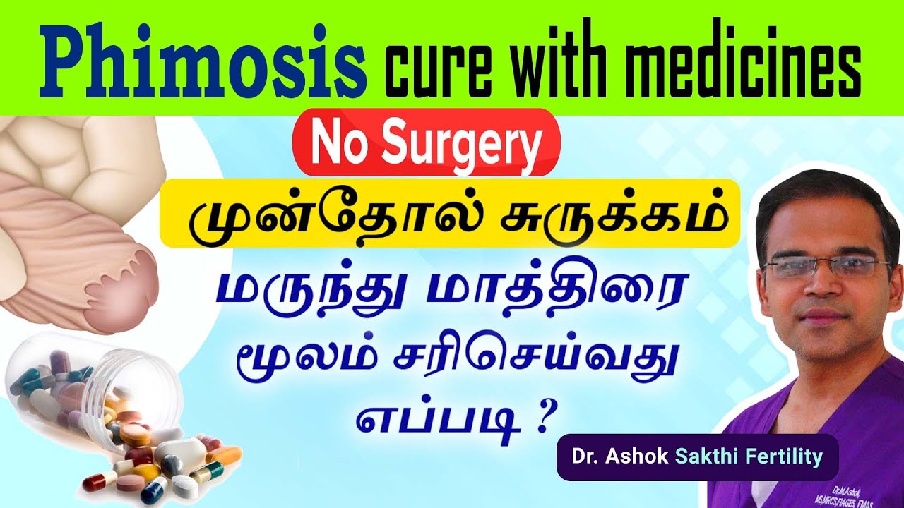 Phimosis cure with medicines | No surgery| முன்தோல் சுருக்கம்  மாத்திரை மருந்து  தீர்வுகள்!