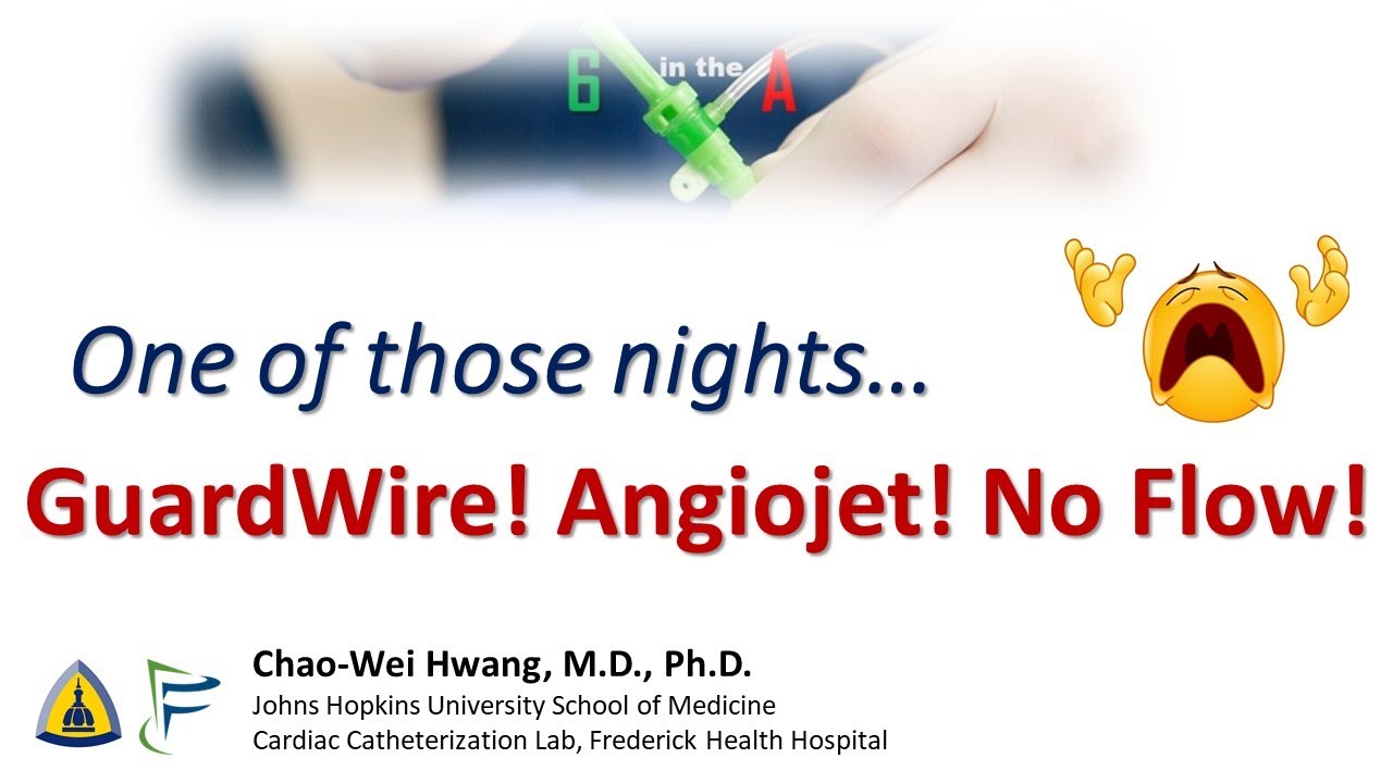 STEMI: GuardWire! Angiojet! No Reflow! One of those nights.