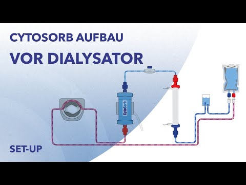 CytoSorb Aufbau: Einsatz vor dem Dialysator