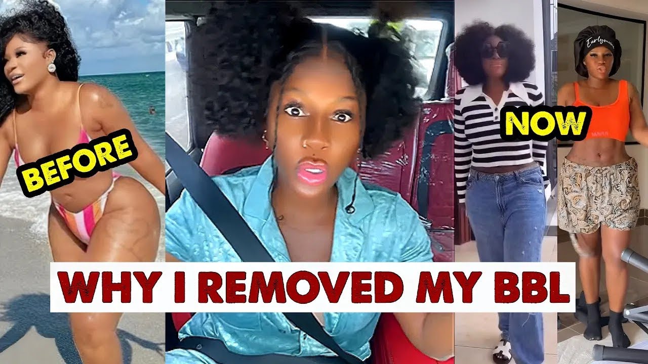 Destiny Etiko Reveals The Shocking Reason Why She Removed Her BBL yansh 