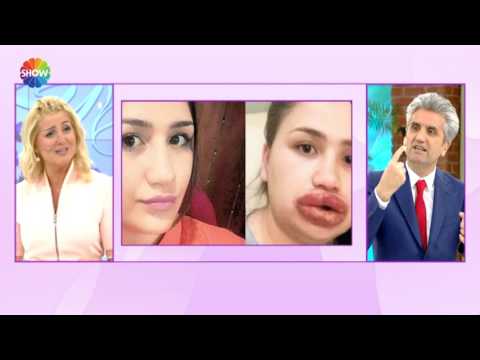 Video: Rusya Yüz Ve Vücuttaki Estetik Ameliyat Sayısı Bakımından Dünyanın Ilk 15 ülkesine Giriş Yaptı