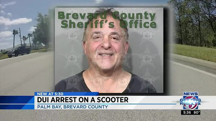 Man on scooter charged with DUI, police say