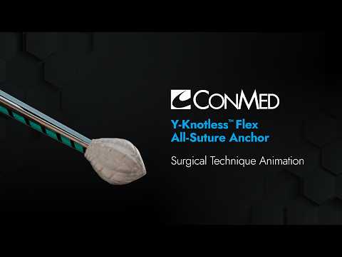 Y-Knotless™ Flex All-Suture Anchor - CONMED Animation
