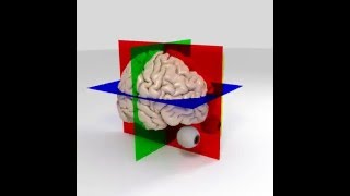 Rotating brain with anatomic planes