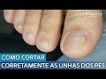 COMO CORTAR CORRETAMENTE AS UNHAS DOS PÉS