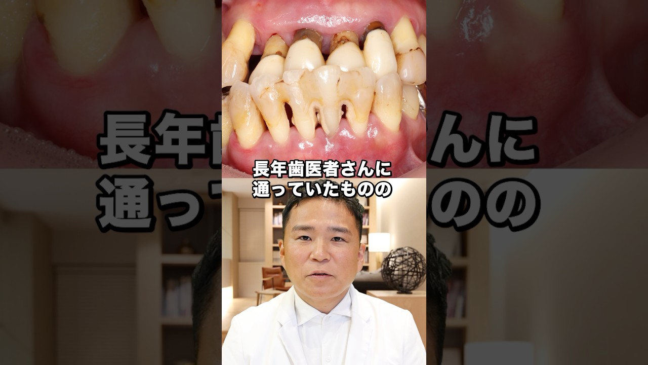 患者さんに喜ばれる少数歯残存症例のトリートメント 【公式通販】