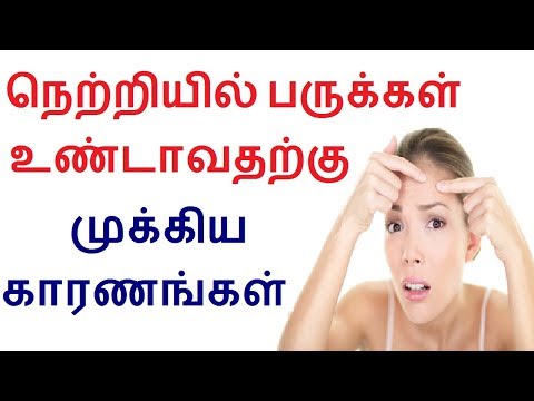 Reasons for pimples on forehead in Tamil | Tamil beauty tips