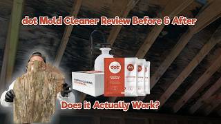 Dot Cleaner Review Before & After Does it Actually Work Profile