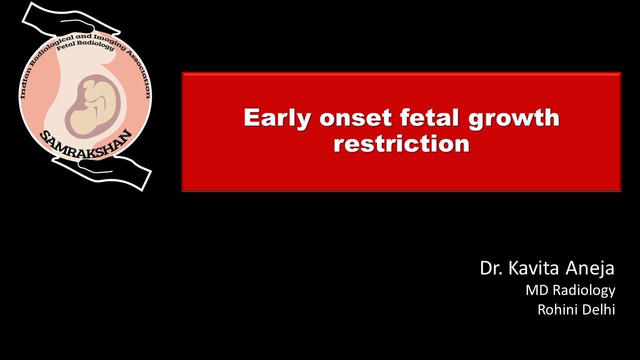 FGR Early Onset Fetal Growth Restriction Early Onset FGR By Dr fgr-early-onset-fetal-growth-restriction-early-onset-fgr-by-dr
