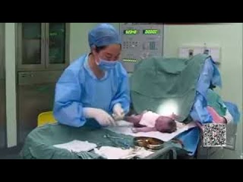 顺产OR剖腹产 产房里谁说了算