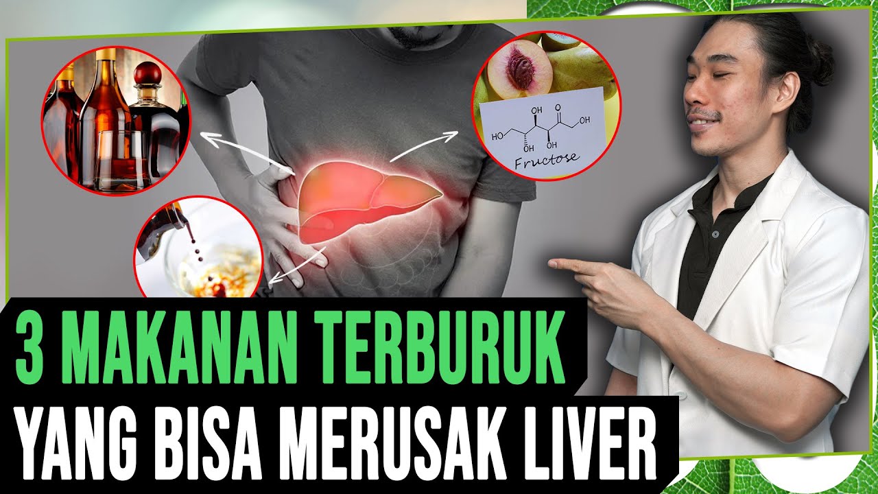 3 MAKANAN TERBURUK YANG BISA MERUSAK LIVER