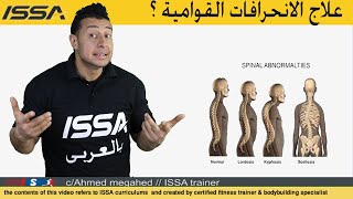 تعرف علي الانحرافات والتشوهات القوامية وكيفية علاجها