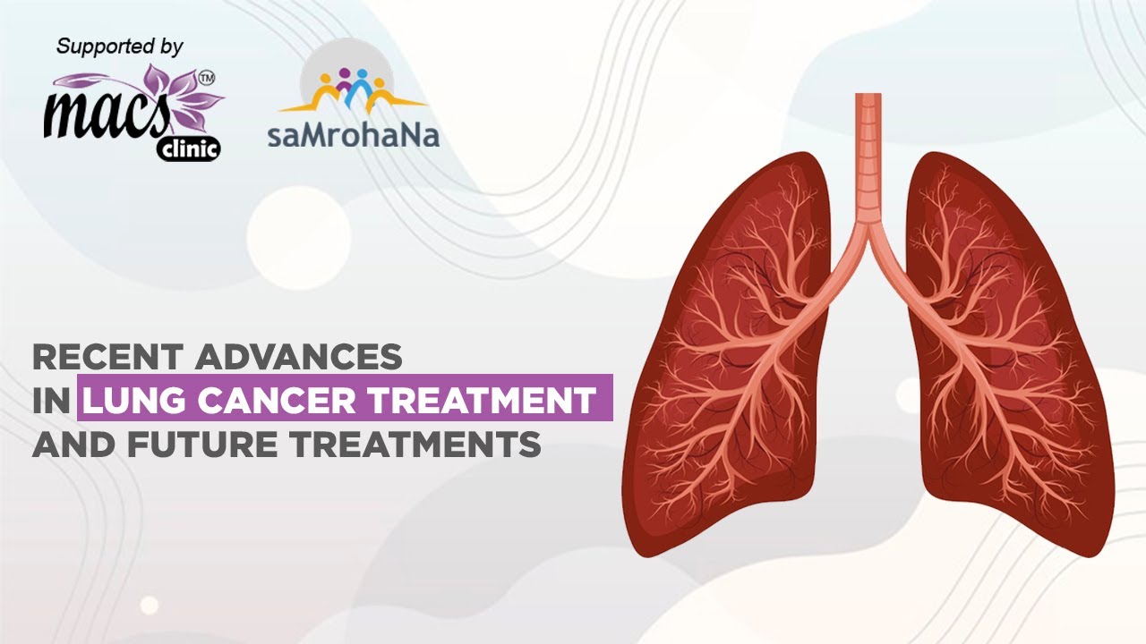 Recent Advances in Lung Cancer Treatment and future treatments ...