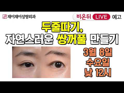 [비온뒤 예고] 두줄따기, 자연스러운 <strong>쌍꺼풀</strong> <strong>만들기</strong> - 유튜브 의학채널 &amp;#39;비온뒤&amp;#39; 생방송 예고