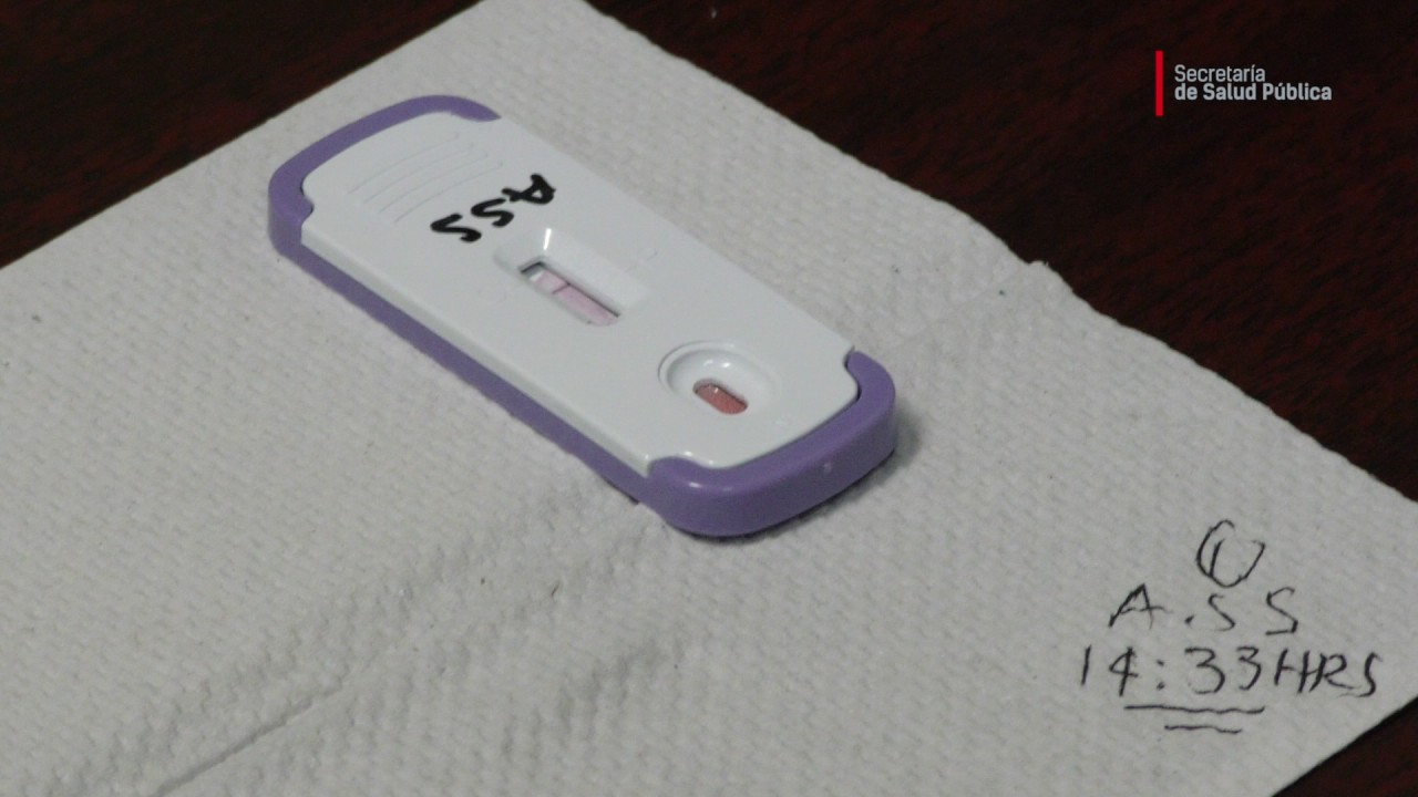 Prueba rapida vih negativa a los 6 meses