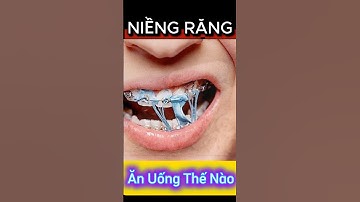 Hướng dẫn ăn uống đúng cách khi niềng răng #shorts #chinhnha #niengrang