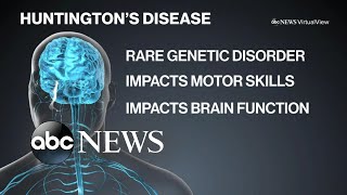 Living with Huntington’s disease