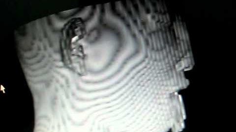 VTK Human Head Visualization 3