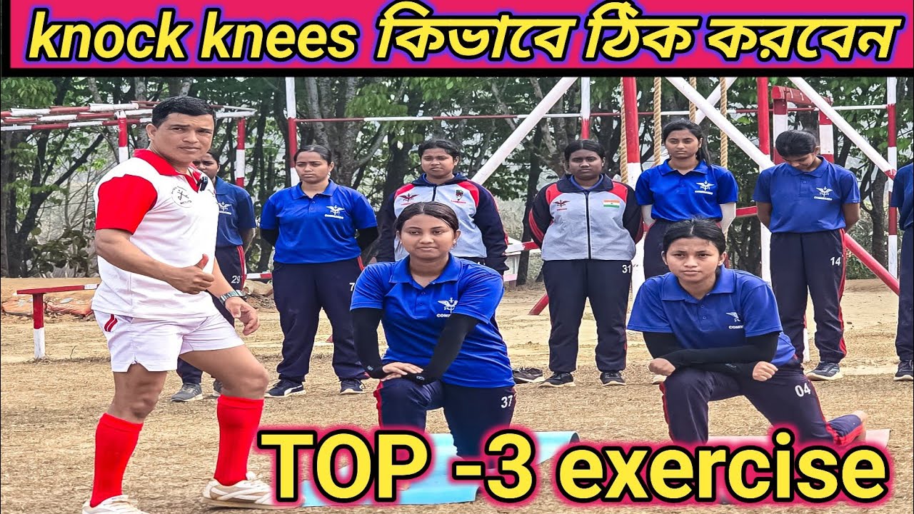 Knock knees  কিভাবে ঠিক করবেন এই ভিডিওর মাধ্যমে দেখুন যারা Inaian Army ssc gd জিডির  প্রস্তুতি নিচ্ছ