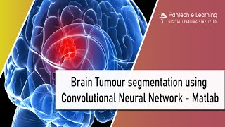 Brain Tumour segmentation using Convolutional Neural Network - Matlab|IEEE Projects|Pantechelearning