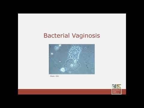 Video: Vulvovaginitis: Penyebab, Gejala, Dan Diagnosis