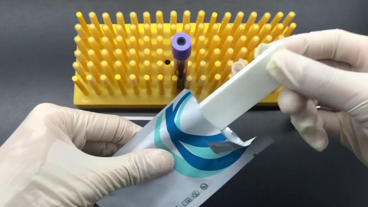 Acro Biotech, Inc Total IgE Test Demo YouTube