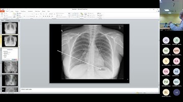 Plain Film Abdominal Imaging - Emergency Department Teaching