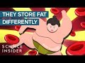 Understanding Sumo Wrestlers' Health