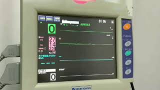 心電図モニター 実際の測定 Asystole 心静止 Nihonkohden Lifescope I Youtube