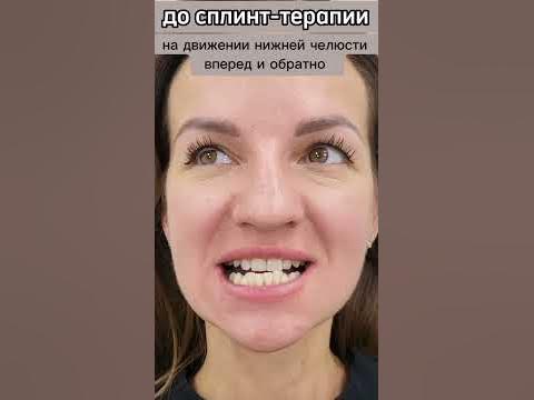 сплинт-терапия - YouTube