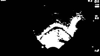 x2 Gaussian blur with Otsu's thresholding for ultrasound images